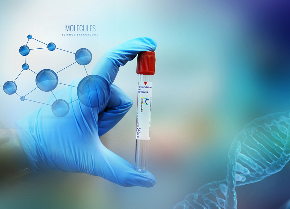 企業(yè)Logo的設(shè)計(jì)形式有哪些？（二）
